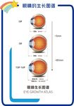 眼軸生長(zhǎng)圖譜