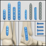 医疗器械 医疗钢板
