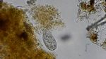显微镜下的细菌微生物视频