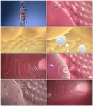 糖尿病医疗演示动画