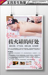 养生拔火罐海报