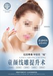 线雕提升术
