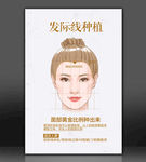 发际线种植