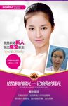 双眼皮真人案例