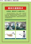 椎间孔镜微创术