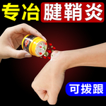 腱鞘炎