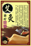 艾灸