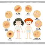 医学皮肤疾病类型