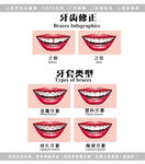 医疗牙齿牙套矫正