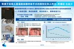 等离子扁桃体腺样体融切术