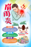 肩周炎