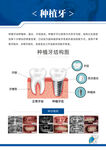 口腔种植牙
