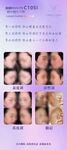 面部美容对比图