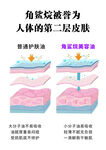 角质层成为人体第二层皮肤
