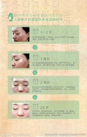 韩方科颜袪痘