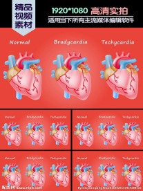 心脏病心律失常动画对比演示