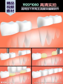 牙桥手术医学演示动画