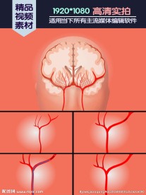 缺血性梗死医学演示动画