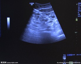 超声波显示全景