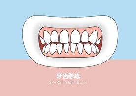 口腔图-牙齿稀疏系列