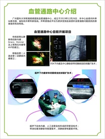 血管通路中心介绍