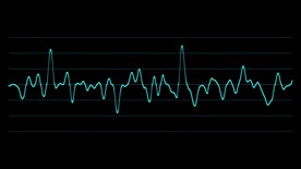 绿色 心电图素材