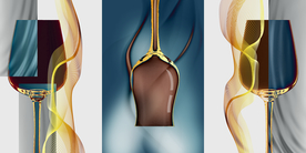 餐厅金色酒杯三联画玄关