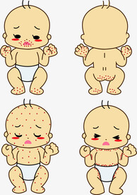 儿童手足口病症状