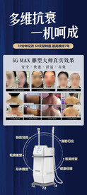 5GMAX