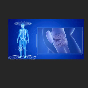 关节活动骨骼健康动画