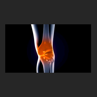 关节活动骨骼健康动画