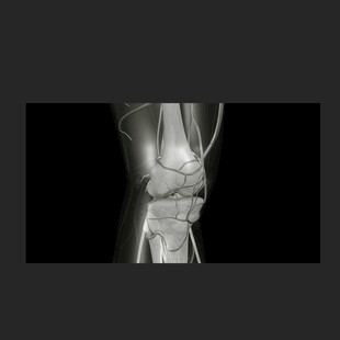 关节活动骨骼健康动画