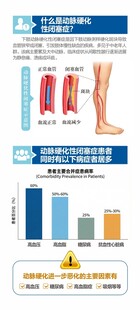 动脉硬化闭赛症