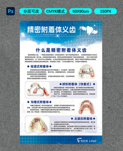 精密附着体义牙